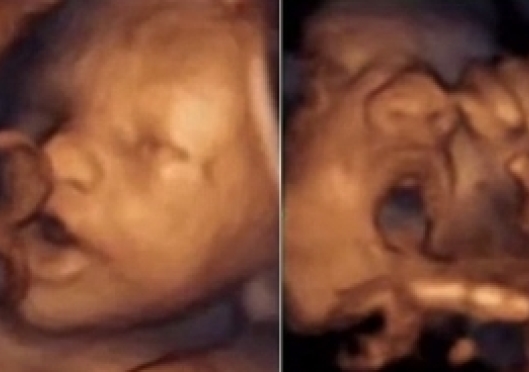 Unborn babies 'sing' as early as 16 weeks in their mother's womb — study